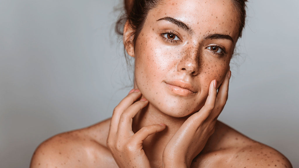 Understanding and Treating Hyperpigmentation: A Comprehensive Guide